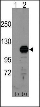 Anti-FRAT1 (center) antibody produced in rabbit saturated ammonium sulfate (SAS) precipitated, buffered aqueous solution