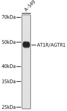 Anti-AT1R/AGTR1 Antibody, clone 8W6G0, Rabbit Monoclonal