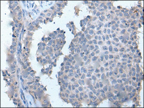 Anti-ZDHHC5 affinity isolated antibody