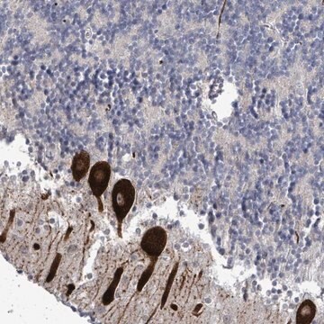 Anti-AMMECR1 antibody produced in rabbit Prestige Antibodies&#174; Powered by Atlas Antibodies, affinity isolated antibody, buffered aqueous glycerol solution