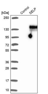 Anti-SELP antibody produced in rabbit Ab1, Prestige Antibodies&#174; Powered by Atlas Antibodies, affinity isolated antibody, buffered aqueous glycerol solution