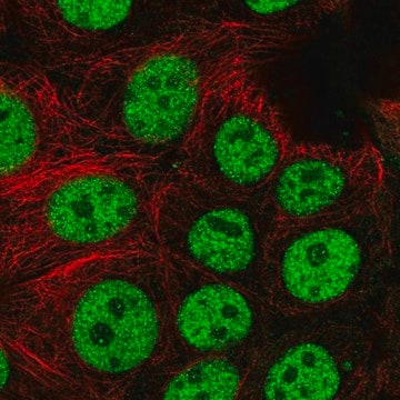 Anti-BCL7C antibody produced in rabbit Prestige Antibodies&#174; Powered by Atlas Antibodies, affinity isolated antibody