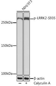 Anti-Phospho-LRRK2-S935 antibody produced in rabbit