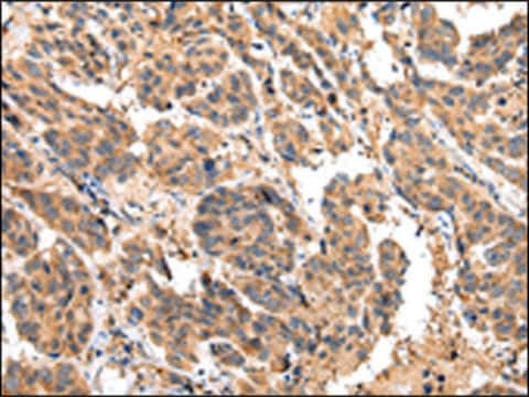 Anti-EPHA2 affinity isolated antibody