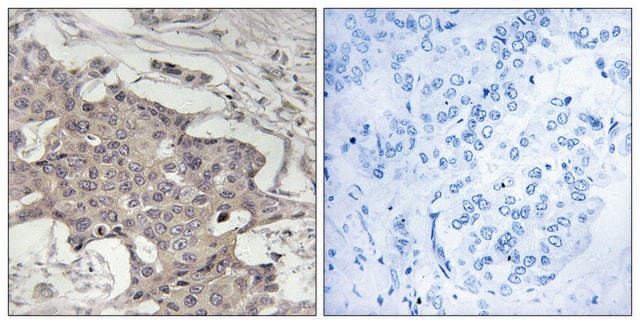 Anti-HIBADH antibody produced in rabbit affinity isolated antibody