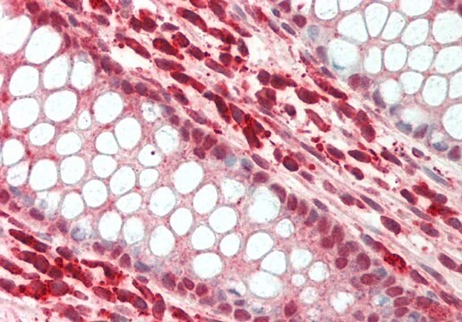 Anti-SNAI3, (N-terminal) antibody produced in rabbit affinity isolated antibody