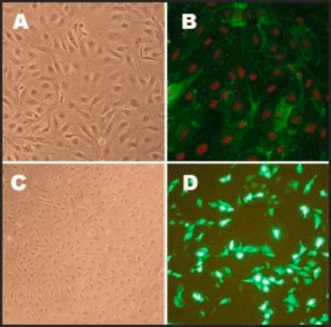 Human Pulmonary Artery Endothelial Cells: HPAEC, adult