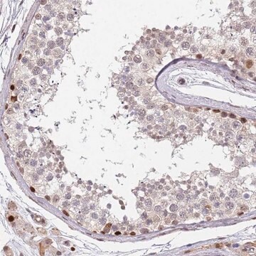 Anti-DPH2 antibody produced in rabbit Prestige Antibodies&#174; Powered by Atlas Antibodies, affinity isolated antibody, buffered aqueous glycerol solution