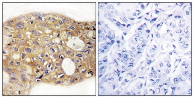 Anti-AGR3 antibody produced in rabbit affinity isolated antibody