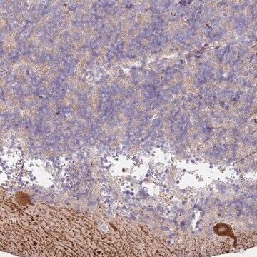 Anti-MTMR14 antibody produced in rabbit Prestige Antibodies&#174; Powered by Atlas Antibodies, affinity isolated antibody, buffered aqueous glycerol solution