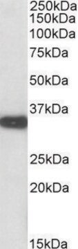 Anti-Aspa (C-terminal) antibody produced in goat affinity isolated antibody, buffered aqueous solution