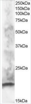 Anti-CABP1 antibody produced in goat affinity isolated antibody, buffered aqueous solution