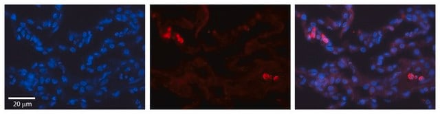 Anti-TRIB1 antibody produced in rabbit affinity isolated antibody