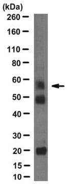 Anticuerpo anti-DC-STAMP, clon 1A2 clone 1A2, from mouse