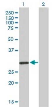 抗KCNRG抗体 マウス宿主抗体 purified immunoglobulin, buffered aqueous solution