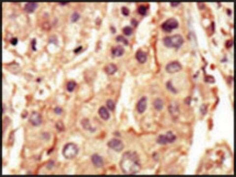 Anti-SRMS (C-term) antibody produced in rabbit IgG fraction of antiserum, buffered aqueous solution