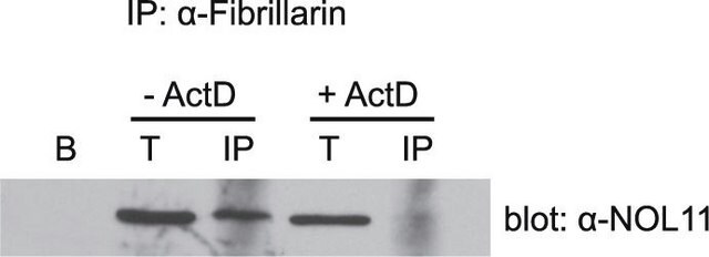 Anti-NOL11 antibody produced in rabbit Prestige Antibodies&#174; Powered by Atlas Antibodies, affinity isolated antibody, buffered aqueous glycerol solution