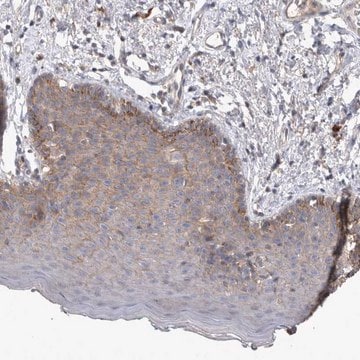 Anti-SRD5A3 antibody produced in rabbit Prestige Antibodies&#174; Powered by Atlas Antibodies, affinity isolated antibody, buffered aqueous glycerol solution