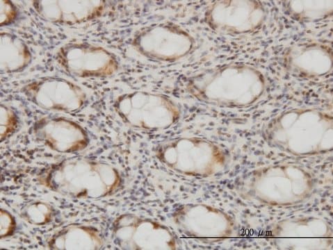 Monoclonal Anti-CSE1L, (C-terminal) antibody produced in mouse clone 2C10, purified immunoglobulin, buffered aqueous solution