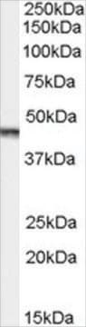 Anti-Aurora Kinase A/AURKA antibody produced in goat affinity isolated antibody, buffered aqueous solution