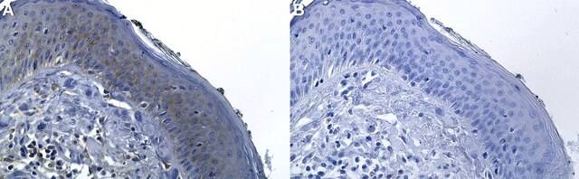 Anti-STAT2 Antibody, clone 1F7 ZooMAb&#174; Rabbit Monoclonal recombinant, expressed in HEK 293 cells