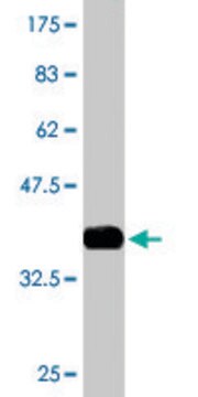 Monoclonal Anti-EPM2A antibody produced in mouse clone 4A12, purified immunoglobulin, buffered aqueous solution