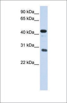 Anti-CDCA5 antibody produced in rabbit affinity isolated antibody