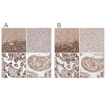 Anti-CBLL1 antibody produced in rabbit Prestige Antibodies&#174; Powered by Atlas Antibodies, affinity isolated antibody, buffered aqueous glycerol solution, Ab2