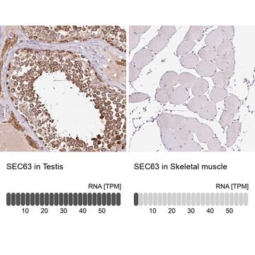 Anti-SEC63 antibody produced in rabbit Prestige Antibodies&#174; Powered by Atlas Antibodies, affinity isolated antibody, buffered aqueous glycerol solution