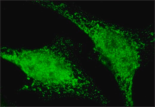 Anti-PLAUR antibody produced in rabbit ~1.0&#160;mg/mL, affinity isolated antibody