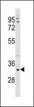 ANTI-TMEM178 (CENTER) antibody produced in rabbit IgG fraction of antiserum, buffered aqueous solution