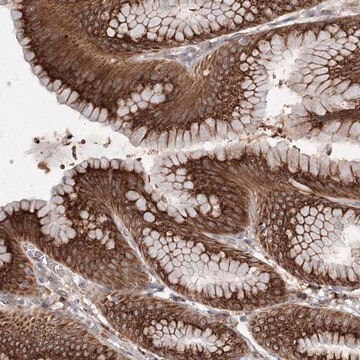 Anti-DIS3L2 antibody produced in rabbit Prestige Antibodies&#174; Powered by Atlas Antibodies, affinity isolated antibody, buffered aqueous glycerol solution