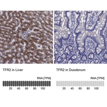 Anti-TFR2 antibody produced in rabbit Prestige Antibodies&#174; Powered by Atlas Antibodies, affinity isolated antibody, buffered aqueous glycerol solution