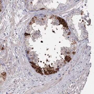 Anti-FDXACB1 antibody produced in rabbit Prestige Antibodies&#174; Powered by Atlas Antibodies, affinity isolated antibody, buffered aqueous glycerol solution