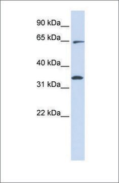 Anti-RHOT1 (ab1) antibody produced in rabbit affinity isolated antibody