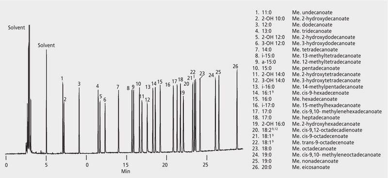 Chromatogram Detail