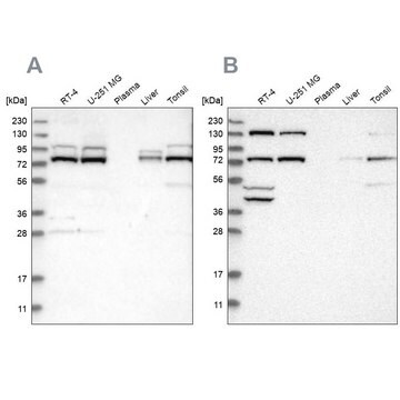 Anti-PLAA antibody produced in rabbit Prestige Antibodies&#174; Powered by Atlas Antibodies, affinity isolated antibody, buffered aqueous glycerol solution, Ab2