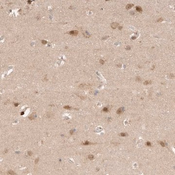 Anti-AHDC1 antibody produced in rabbit Prestige Antibodies&#174; Powered by Atlas Antibodies, affinity isolated antibody, buffered aqueous glycerol solution, ab2