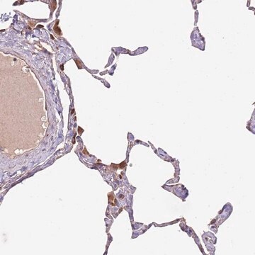 Anti-DOCK6 antibody produced in rabbit Prestige Antibodies&#174; Powered by Atlas Antibodies, affinity isolated antibody, buffered aqueous glycerol solution