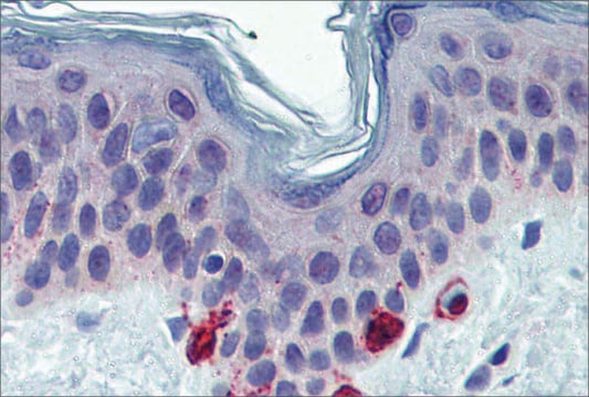 Anti-TYRP1 antibody produced in rabbit affinity isolated antibody