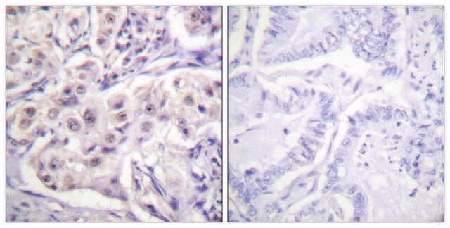 Anti-HNRPD antibody produced in rabbit affinity isolated antibody