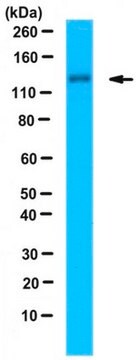 Anti-Eps15 Antibody serum, from rabbit