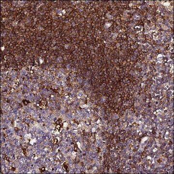 Anti-IL4I1 antibody produced in rabbit Prestige Antibodies&#174; Powered by Atlas Antibodies, affinity isolated antibody, buffered aqueous glycerol solution