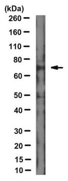 Anti-Merlin (NF2) Antibody, clone 1C4 clone 1C4, from mouse