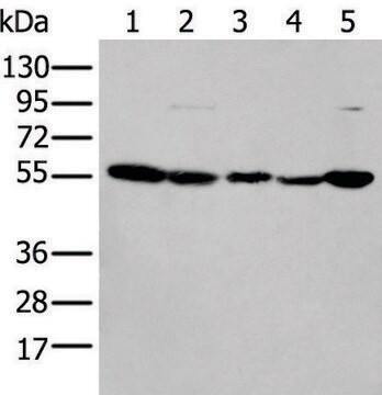 Anti-PFKFB3 affinity isolated antibody