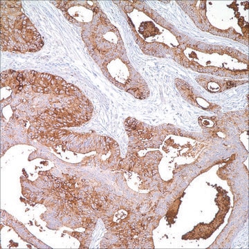 BG8, LewisY (F3) Mouse Monoclonal Antibody