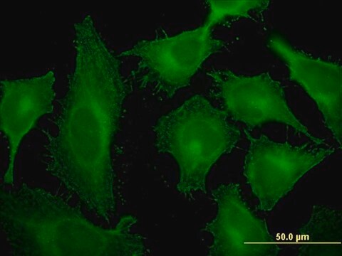 Monoclonal Anti-TMOD3, (C-terminal) antibody produced in mouse clone 1E1, purified immunoglobulin, buffered aqueous solution