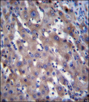 ANTI-RPGR (C-TERM) antibody produced in rabbit IgG fraction of antiserum, buffered aqueous solution