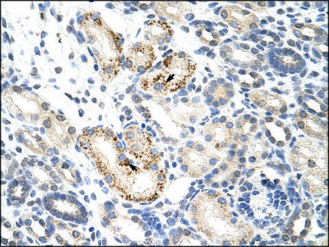 Anti-NOC4L antibody produced in rabbit affinity isolated antibody