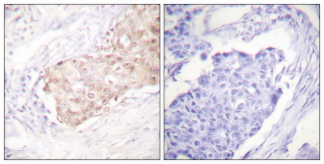 Anti-EDD antibody produced in rabbit affinity isolated antibody